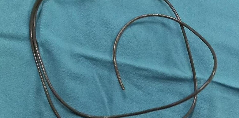 Мужчина засунул в пенис шнур от наушников «для удовлетворения», но вытащить его не смог - «Клуб - Юмора»