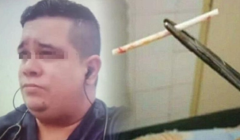 Фейковый хирург из Венесуэлы вживлял пациенткам палочки от леденца в качестве противозачаточного - «Клуб - Юмора»