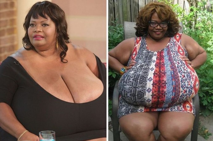 Женщина разбогатела и прославилась благодаря 60-килограммовой груди - «Клуб - Юмора»