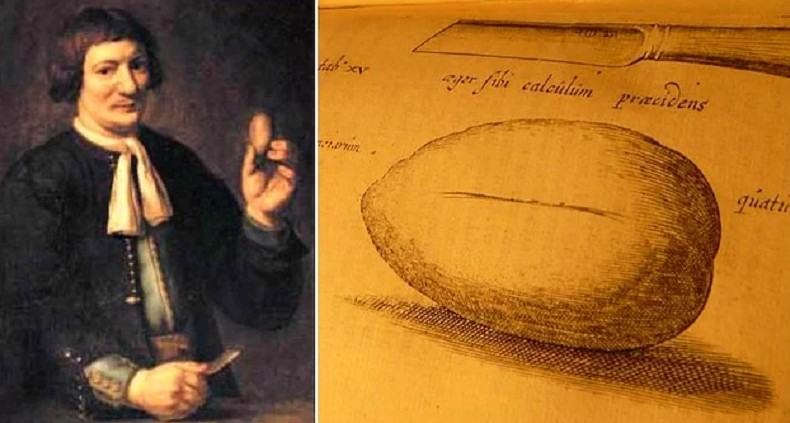 Как кузнец себе литотомию сделал - «Клуб - Юмора»