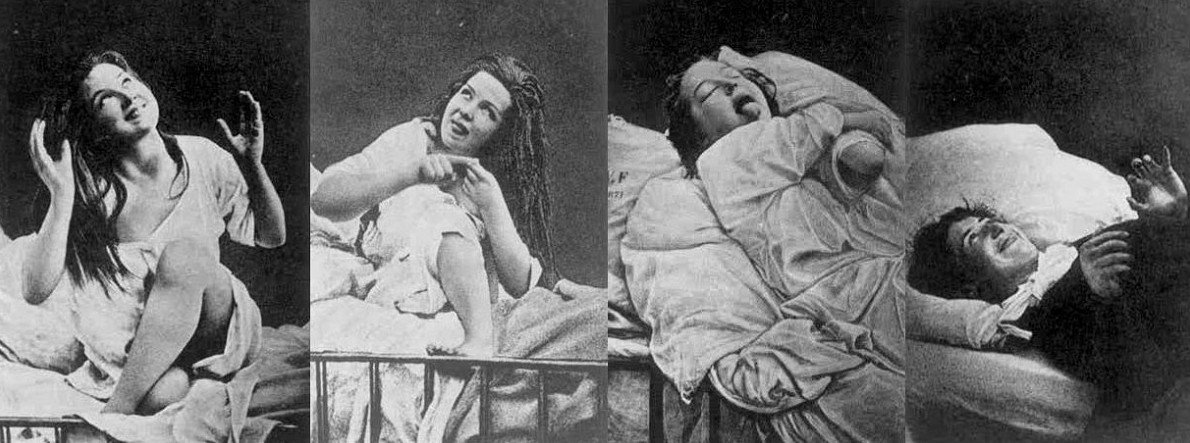 Лечение сексуальных расстройств у женщин в конце 19 столетия - «Клуб - Юмора»