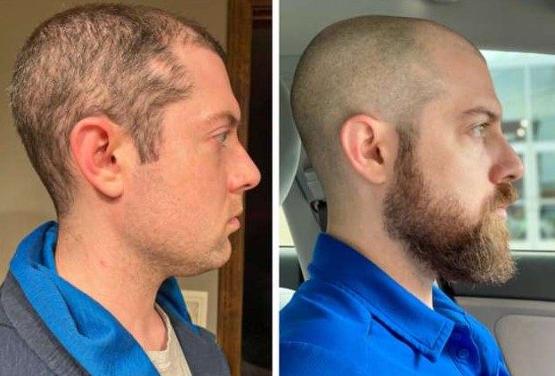 18 мужчин, которые отпустили бороду и жалеют, что не сделали этого раньше - «Клуб - Юмора»
