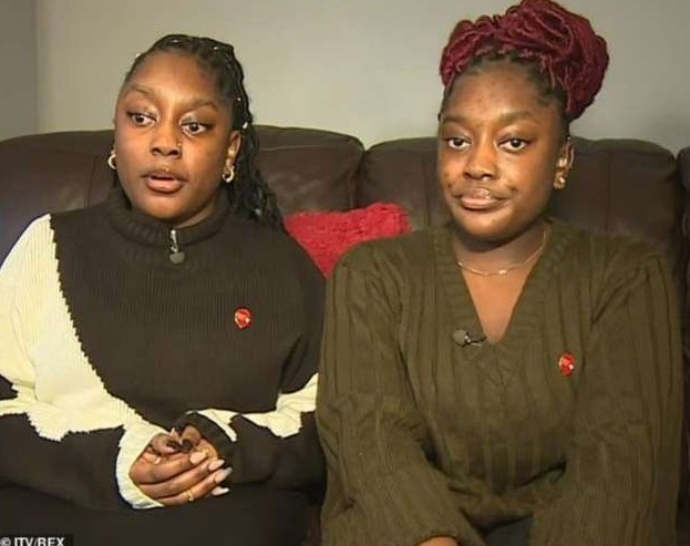 Сиамским близнецам, пережившим операцию по разделению позвоночника, уже по 20 лет - «Клуб - Юмора»