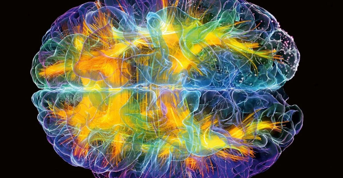 Мы уже используем мозг на 100% - «Клуб - Юмора»